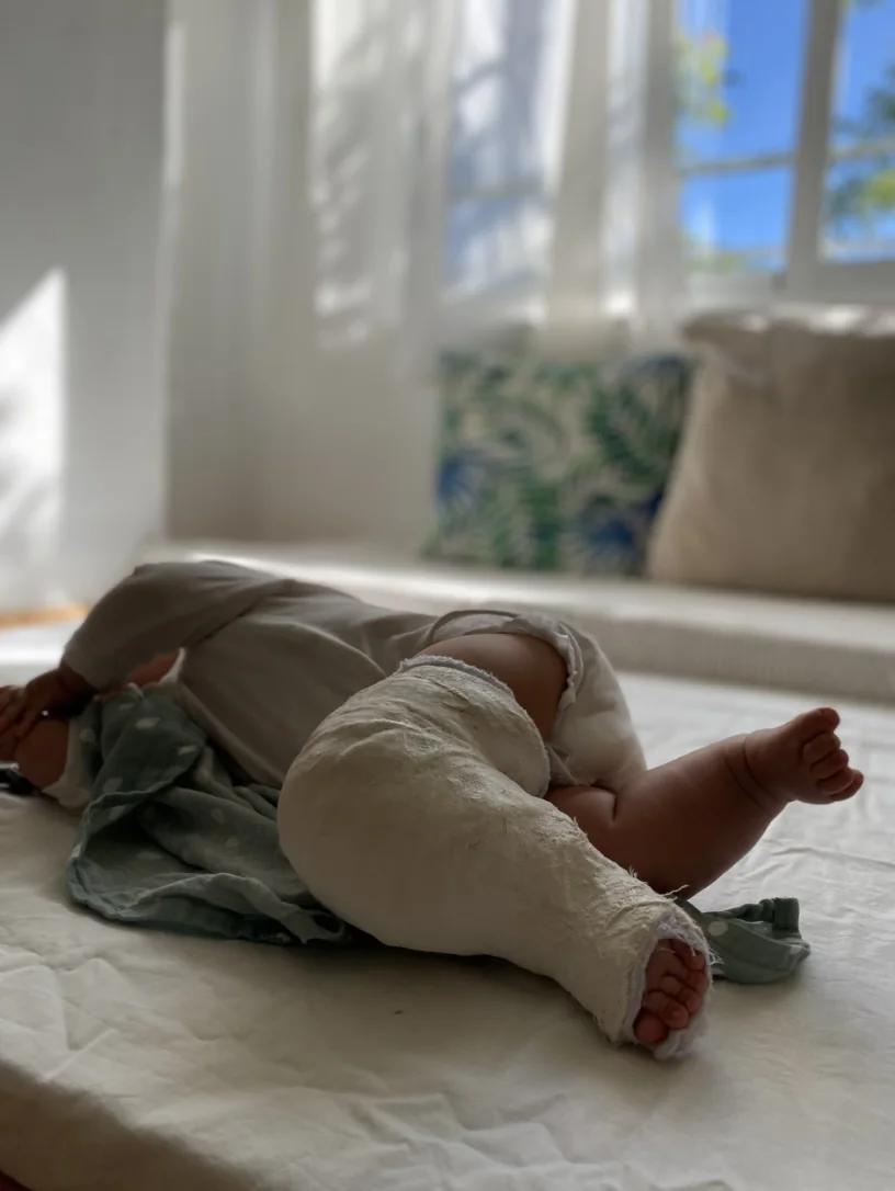 Un bebé tumbado junto a la ventana, con la pierna escayolada