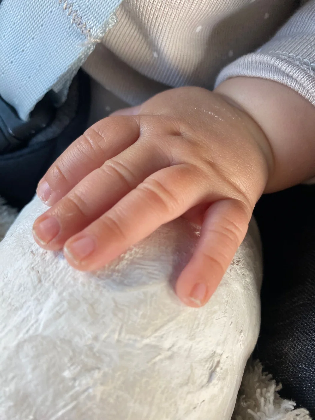 Una mano de bebé apoyada sobre su propia escayola